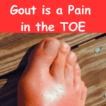 what is gout - health info