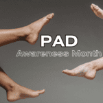 feature pad - peripheral artery disease month