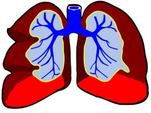 lung problems explained