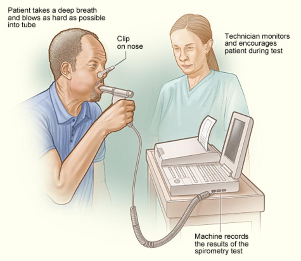 COPD testing Sacramento - spirometry test 